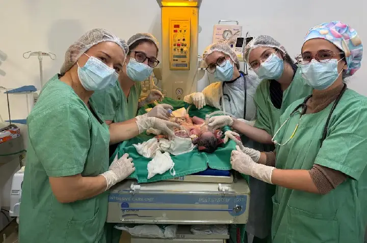 Siameses do Tocantins nascem em Goiânia e médicos apontam condições viáveis para separação