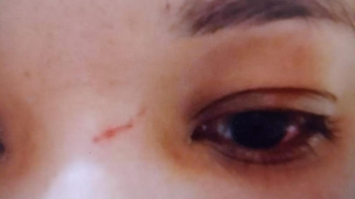 Acusado de quebrar dentes da companheira, teria dito á mulher que mudaria seu comportamento