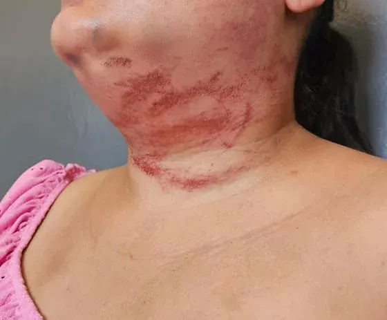 Homem mantém ex em cativeiro e usa corda para tenta matar enforcada