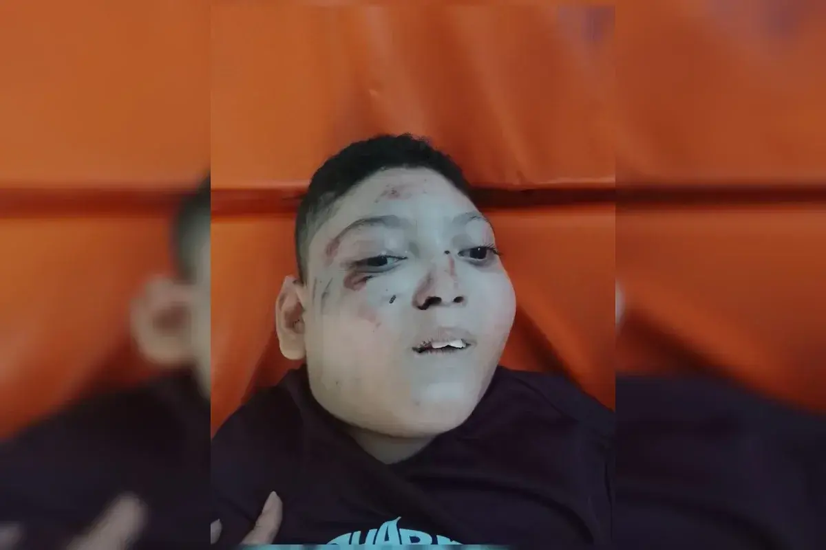 Cadeirante fica ferido ao cair da cadeira de rodas na escada rolante do metrô DF
